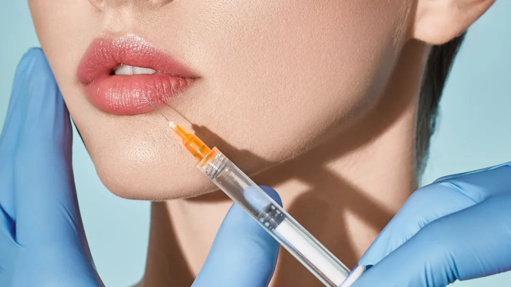 Lip Fillers Treatment Photo