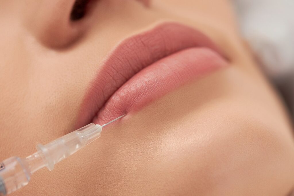 lip fillers injection treatment