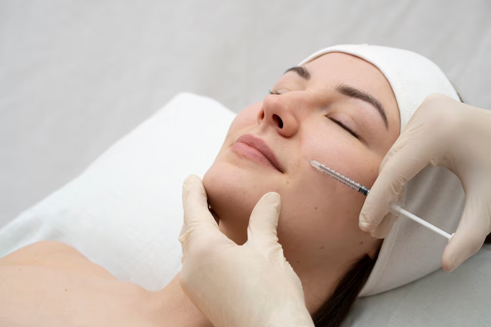 Microneedling