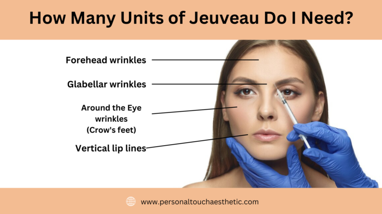 How Many Units of Jeuveau Do I Need